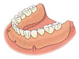 入れ歯（保険適用の場合）